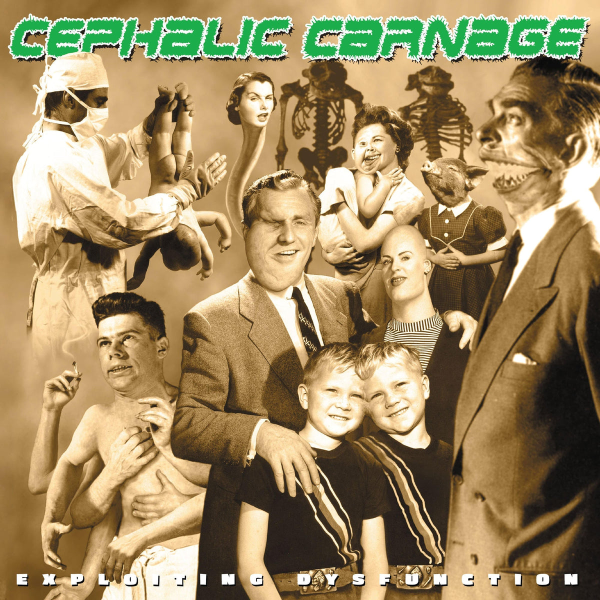 Cephalic Carnage - Exploiting Dysfunction (Deluxe 25Th Anniversary Reissue) (Bone White & Gold Merge Vinyl) [2Lp] Vinyl