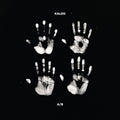 Kaleo - A/B (Indie Exclusive) [Black & White Vinyl] [2LP] Vinyl